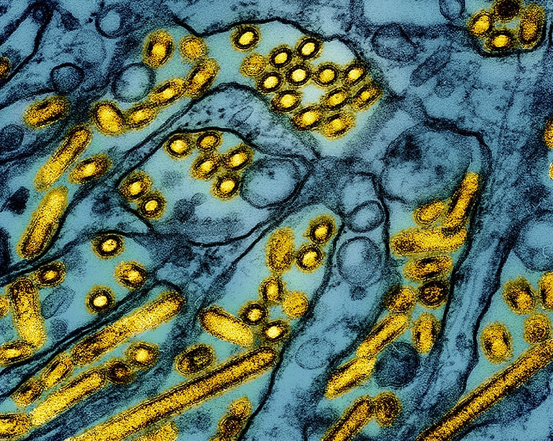 Virus Influenza Aviaire Hautement Pathogène H5N1 (Crédit Photo : CDC et NIAID) Image réalisée au microscope électronique à transmission de particules du virus de la grippe aviaire A H5N1 (jaune), cultivées dans des cellules (MDCK) (bleu). Microscopie par CDC ; repositionné et recoloré par NIAID.​